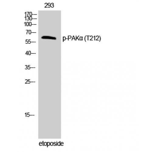 PAK1 Antibody (150-230 aa)