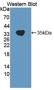 Polyclonal Rabbit anti-Human IMPDH2 Antibody (aa226-514, WB)