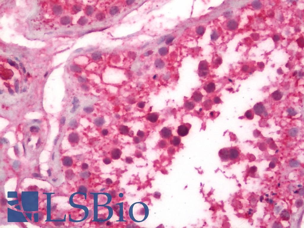 IHC-plus™ MIS12 Antibody (aa1-50)