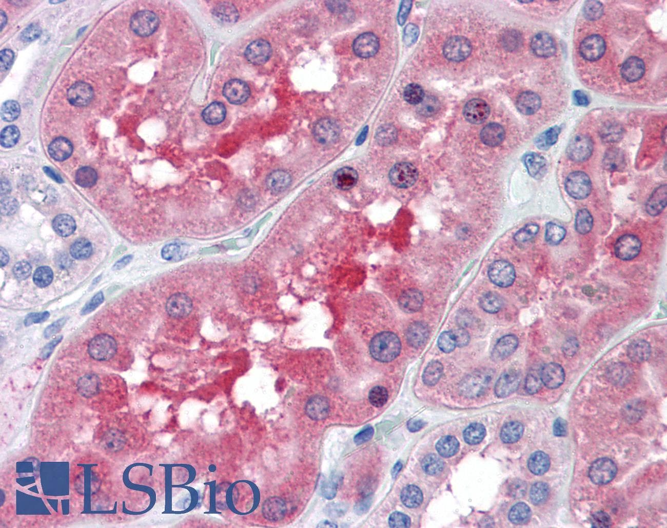 IHC-plus™ Monoclonal Mouse anti-Human BBOX1 / BBOX Antibody (clone 6H3, IHC, WB)