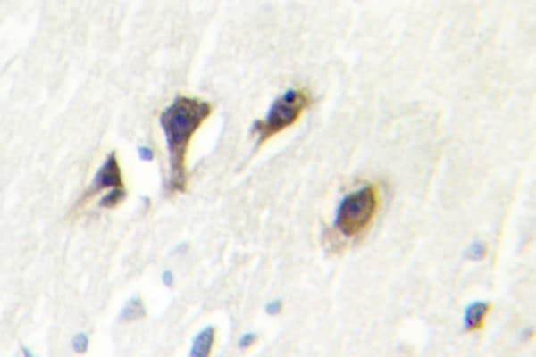 MAPK10 / JNK3 Antibody (Lys391)