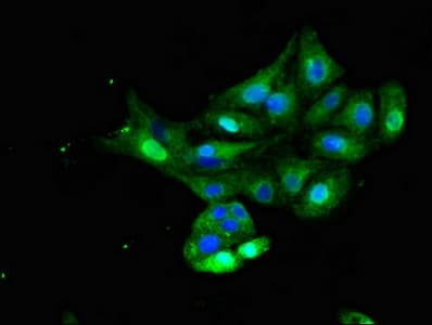 INSR / Insulin Receptor Antibody