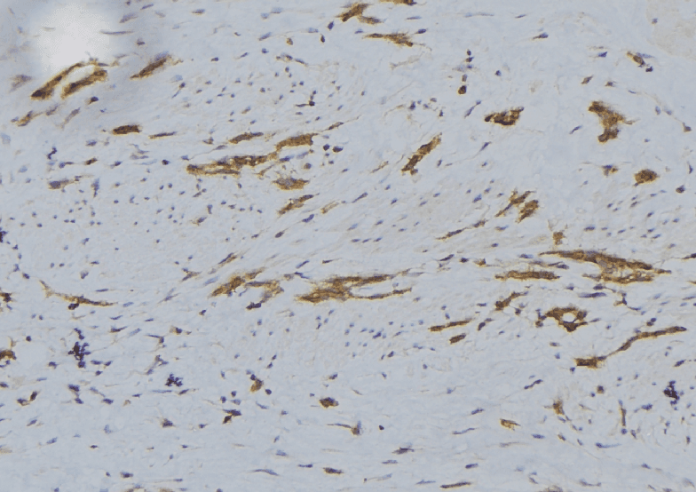 CHST12 Antibody