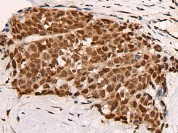 Polyclonal Rabbit anti-Human HGH1 / FAM203A Antibody (IHC)