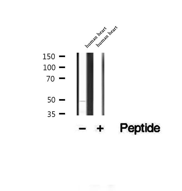 CFHR3 / CFHL3 Antibody
