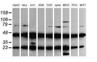 MAP2K1 / MKK1 / MEK1 Antibody (clone OTI2A9)