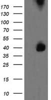 MAP2K3 / MEK3 / MKK3 Antibody (clone OTI2D7)