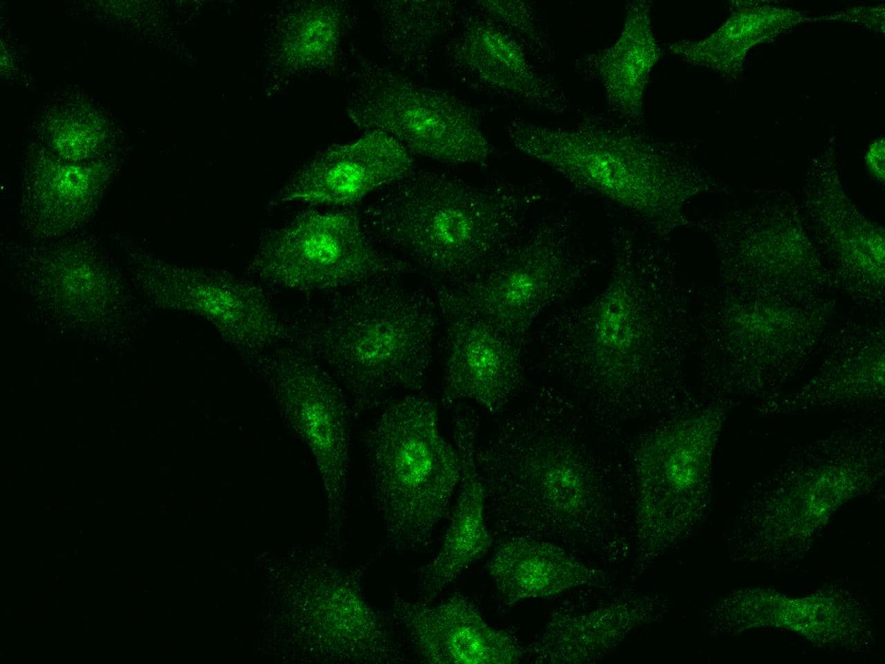 Polyclonal Rabbit anti-Human RBPMS / Hermes Antibody (IHC, IF)