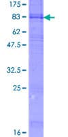 Human ANKH Protein (Recombinant GST)