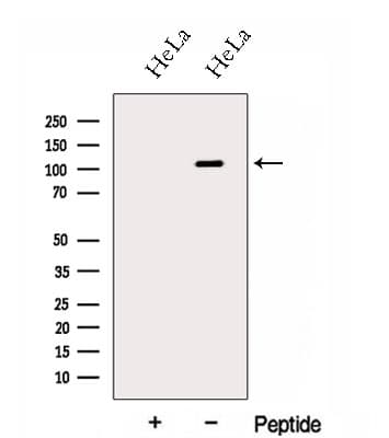 HPS3 Antibody