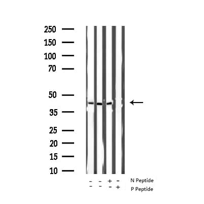 Polyclonal Rabbit anti-Human GATA4 Antibody (phospho-Ser262, IHC, IF, WB)