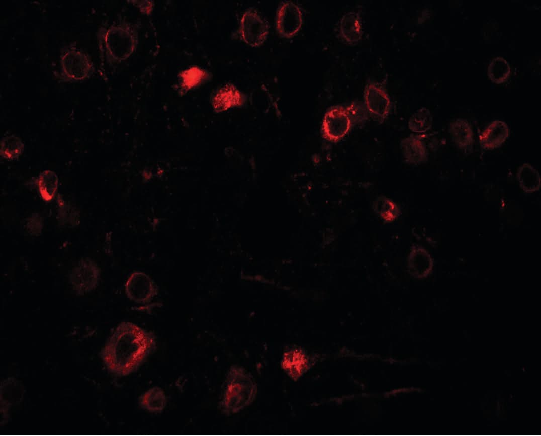 IHC-plus™ Polyclonal Rabbit anti-Human TPT1 / TCTP Antibody (IHC, IF, WB)