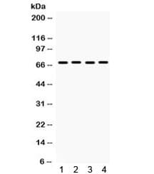 PEA3 / ETV4 Antibody