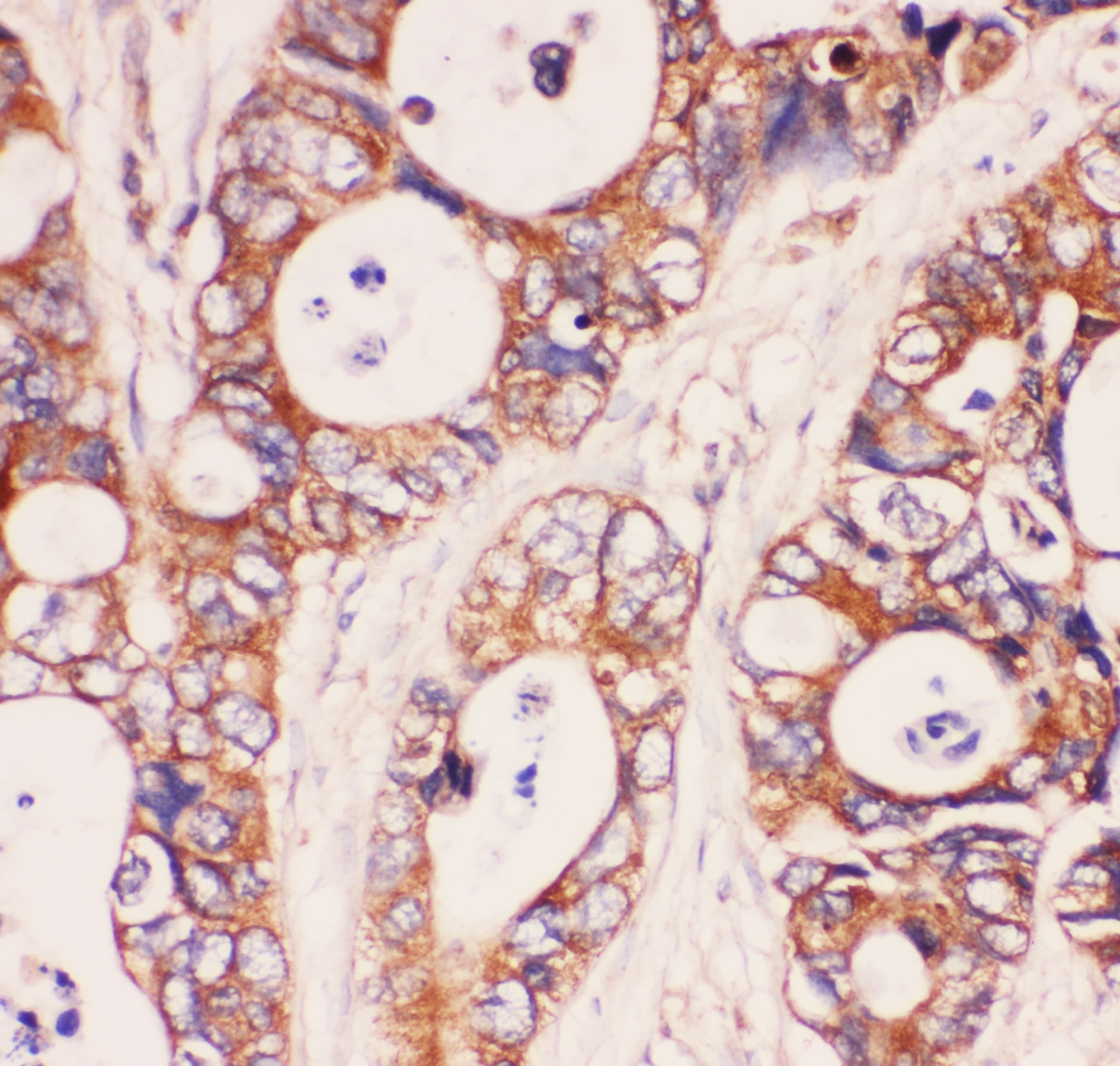 Polyclonal Rabbit anti-Human MYD88 Antibody (aa44-264, IHC, WB)