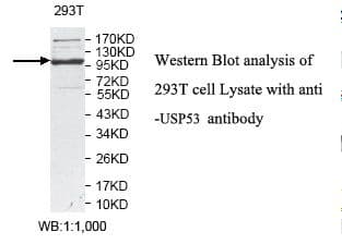 IHC-plus™ Polyclonal Rabbit anti-Human USP53 Antibody (aa2-188, IHC, WB)