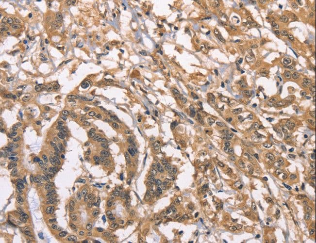 PEBP1 / RKIP Antibody