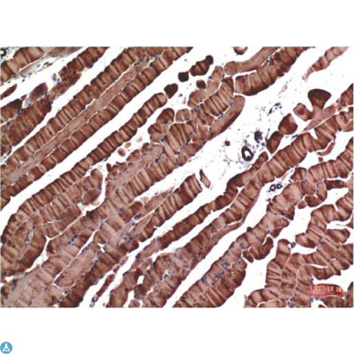 Monoclonal Mouse anti-Human Muscle Actin Antibody (IHC)