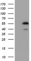 EPHX2 / Epoxide Hydrolase 2 Antibody (clone OTI2G2)