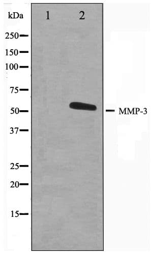 MMP3 Antibody