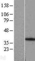 ANKRA2 / ANKRA Protein (Over-Expression Lysate Myc-DDK (Flag))