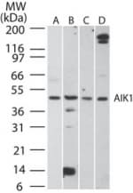 IHC-plus™ Polyclonal Rabbit anti-Human AURKA / Aurora-A Antibody (aa100-150, IHC, WB)