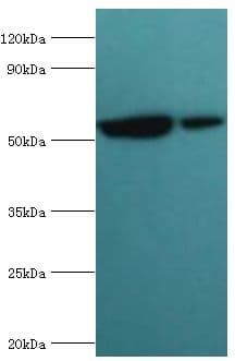 MUTYH / MYH Antibody (aa1-265)