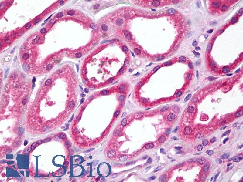 IHC-plus™ OPRK1 / Kappa Opioid Receptor Antibody (aa366-380)