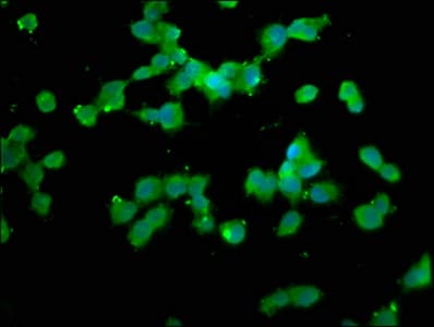 NALP1 / NLRP1 Antibody