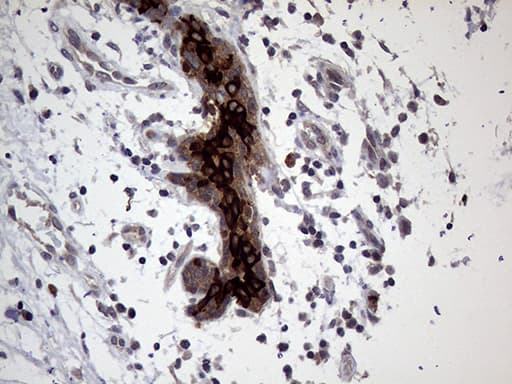 Monoclonal Mouse anti-Human AGR2 Antibody (clone OTI2B10, Carrier-free, aa21-175, IHC, WB)