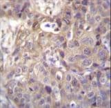HIPK1 Antibody (aa893-922)