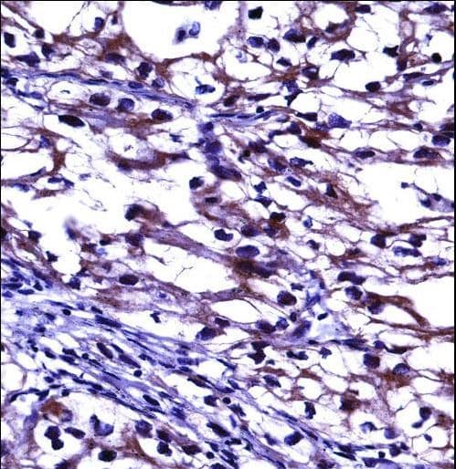Polyclonal Rabbit anti-Human OPG / Osteoprotegerin Antibody (aa243-271, IHC, IF, WB)