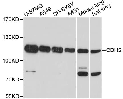 CD144 / CDH5 / VE Cadherin Antibody