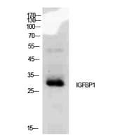 IGFBP1 Antibody