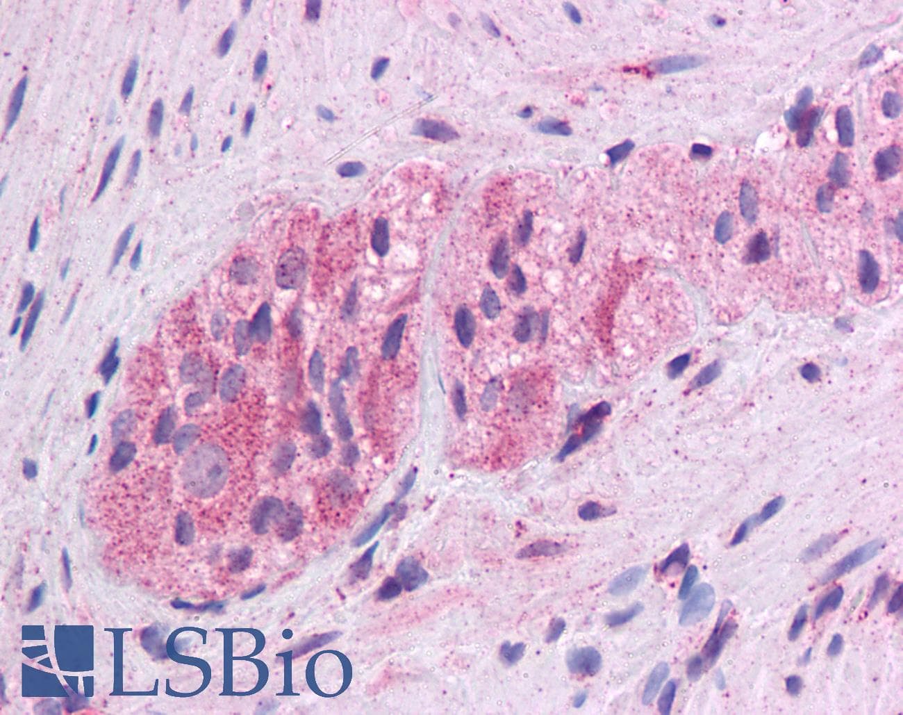 WNT5A Antibody (aa180-229)