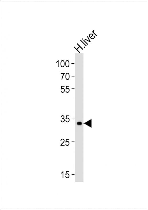 LRTOMT Antibody (aa2-36)
