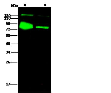 Influenza B Hemagglutinin Antibody (Preservative Free)