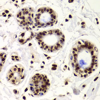 Polyclonal Rabbit anti-Human XRCC6 / Ku70 Antibody (IHC, IF, WB)