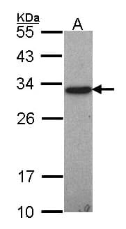 Polyclonal Rabbit anti-Human GSTO1 Antibody (aa30-241, IHC, WB)