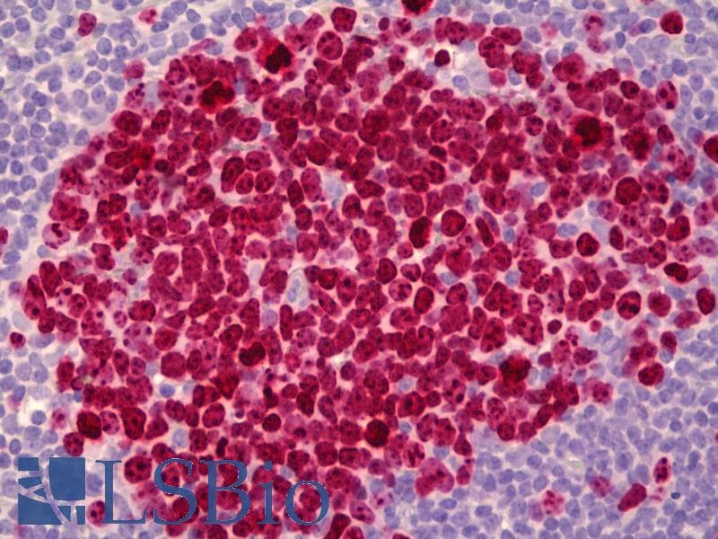 IHC-plus™ Monoclonal Mouse anti-Human MKI67 / Ki67 Antibody (clone Ki-S5, IHC, WB)