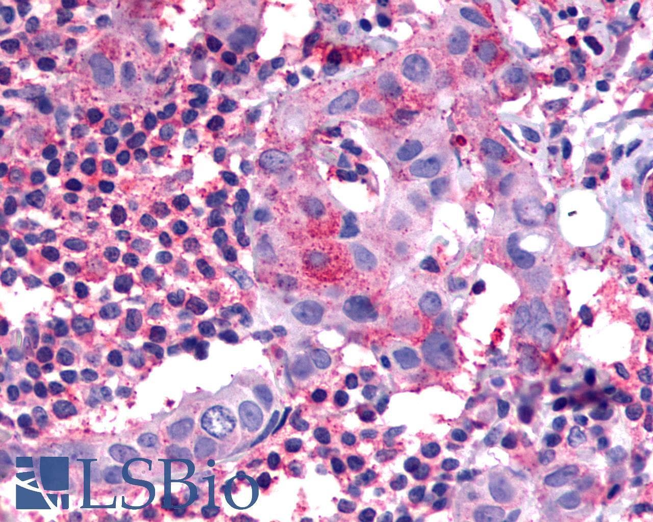 PathPlus™ SSTR1 Antibody (N-Terminus)