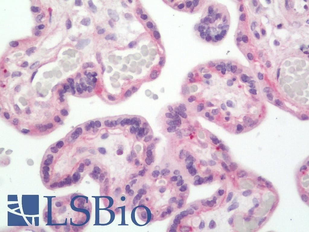 LAMC1 / Laminin Gamma 1 Antibody (HRP)
