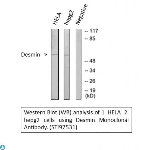 DES / Desmin Antibody