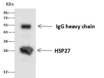 HSPB1 / HSP27 Antibody (Preservative Free)