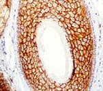 Polyclonal Rabbit anti-Human CLDN1 / Claudin 1 Antibody (IHC)