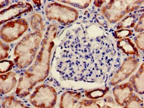 Polyclonal Rabbit anti-Human ONECUT2 / OC2 Antibody (IHC, WB)