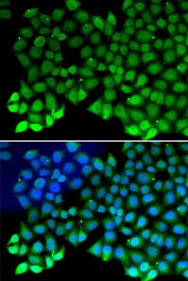 RPA70 / RPA1 Antibody