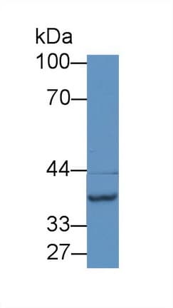 SLC38A1 / NaT2 Antibody (aa20-280, HRP)