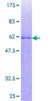 Human TP53TG5 Protein (Recombinant GST)