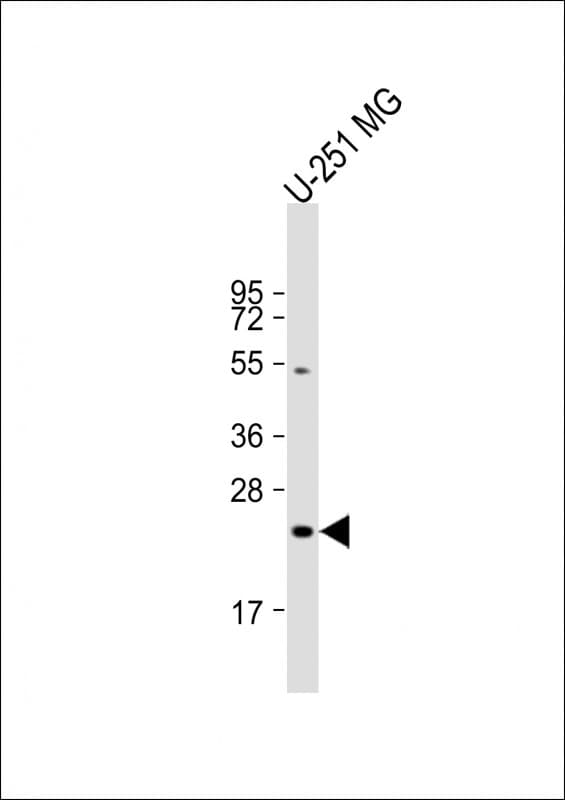 LHPP Antibody (Internal)