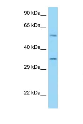 HLA-E Antibody (aa158-207)
